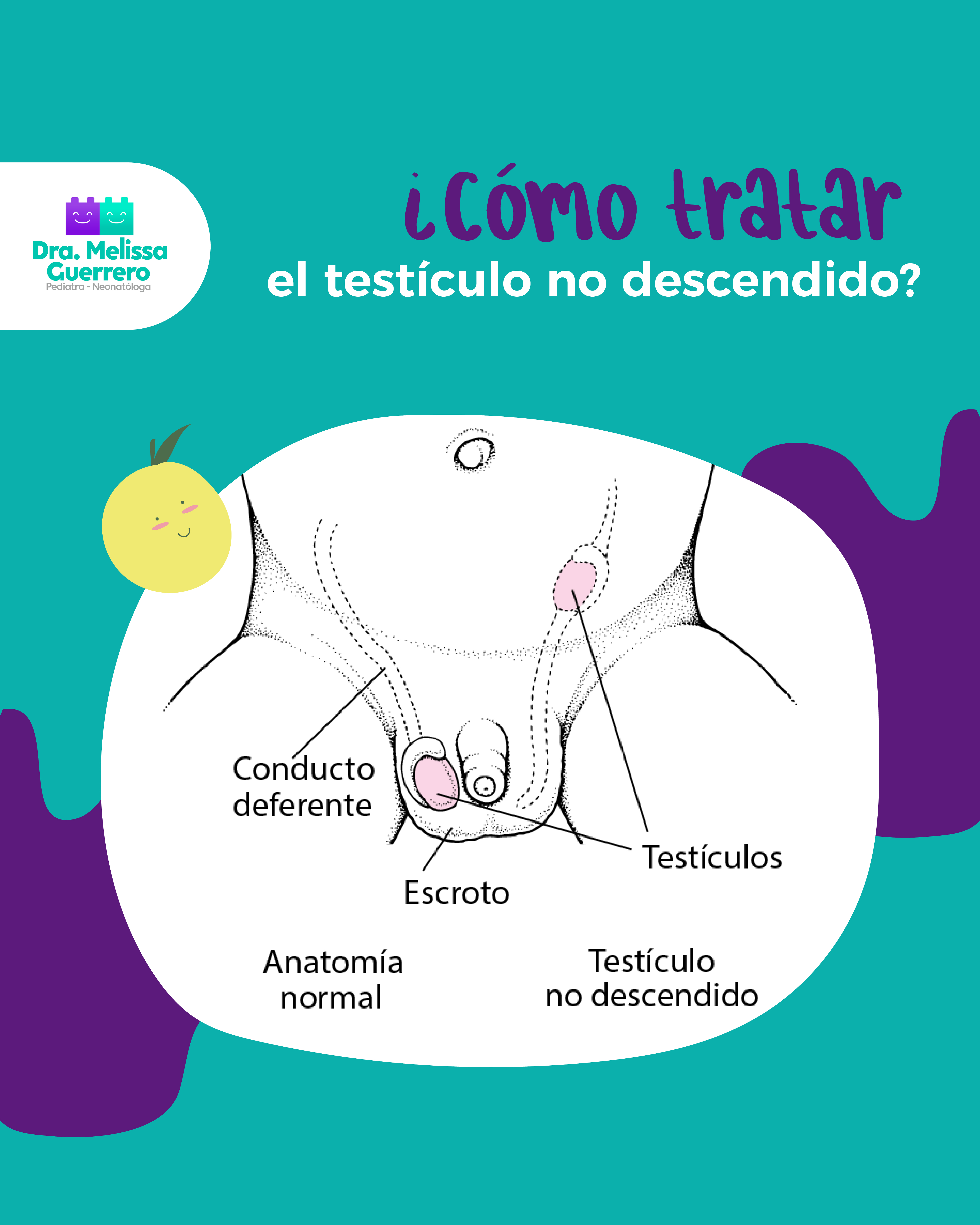 Testículo que no ha descendido